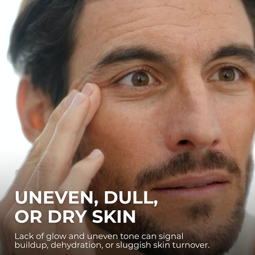Man touching his face with text about skin concerns: uneven, dull, or dry skin